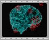 brain
